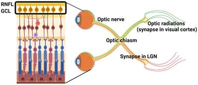 Utility of the visual system to monitor neurodegeneration in multiple sclerosis